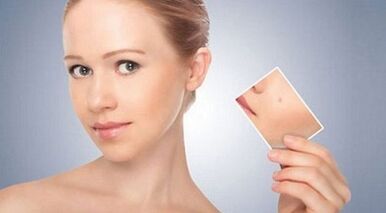 pregled učinkovitih lijekova za bradavice i papilome